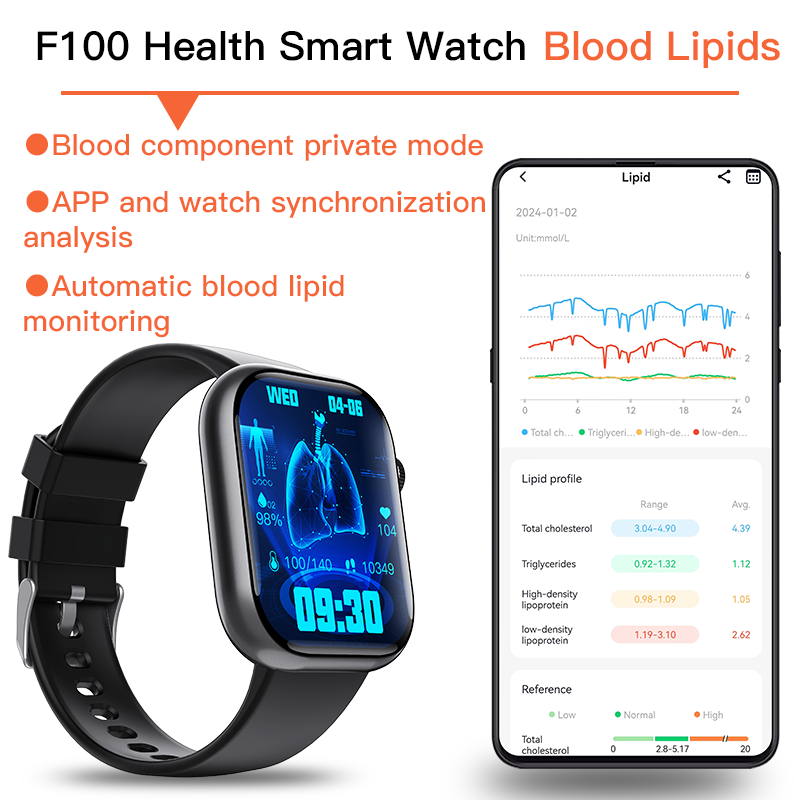 El mejor reloj inteligente con ECG de 2025, con monitor de presión arterial y glucosa en sangre