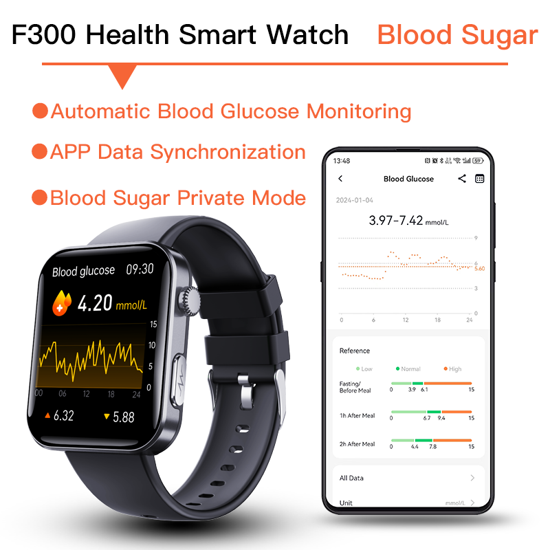 Reloj inteligente con ECG y monitor de presión arterial, temperatura corporal, glucosa en sangre, frecuencia cardíaca, oxígeno en sangre.